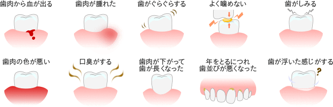歯周病の症状